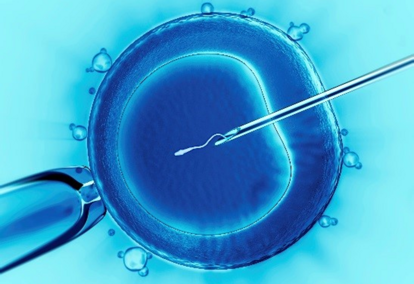 20250703 Frau Denkhaus InVitroFertilization (002)